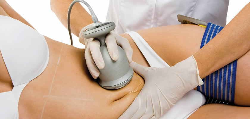 Ultrasound Cavitation