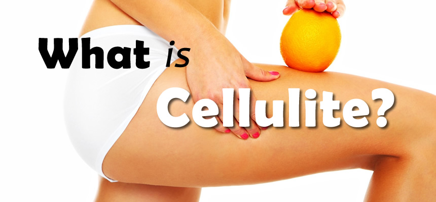 Cellulite